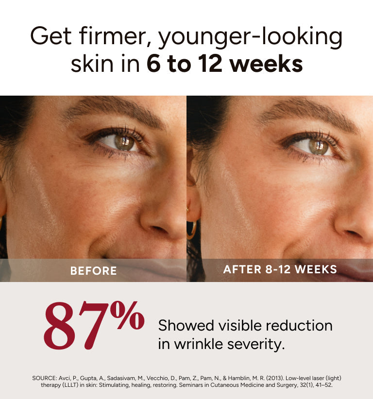 Renew Red Light Therapy Mask